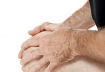 Osteoporosis Treated With Herbal Medicine