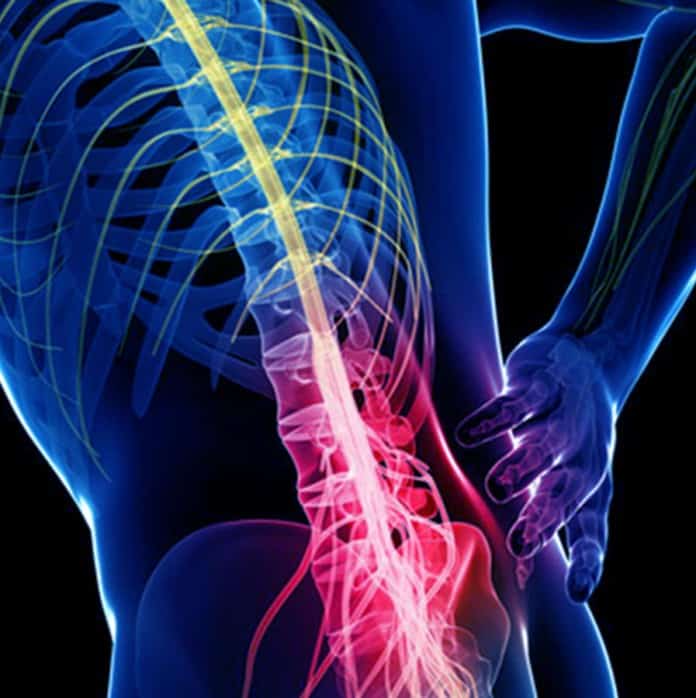 chronic back pain CROP