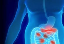 8 Autoimmune-Inflammation Systems We Need To Talk About More