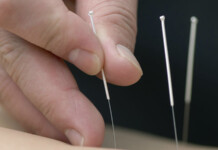 Is Acupuncture Any Help For People Living with Depression?