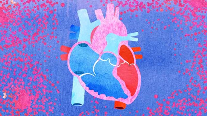 chemotherapy and stroke