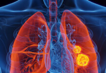 Researchers Train AI To Diagnose Lung Diseases