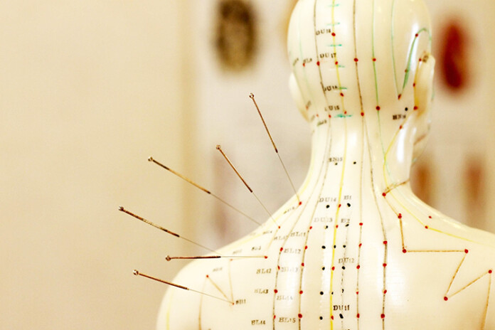 acupuncture