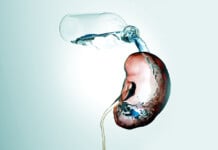 Not All Diabetes Is About Sugar