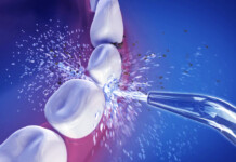 Sugar Starts Corroding Your Teeth Within Seconds Of Eating It