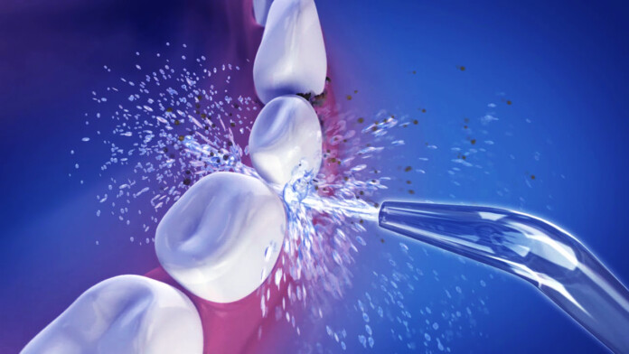 water flossing ORIGINAL