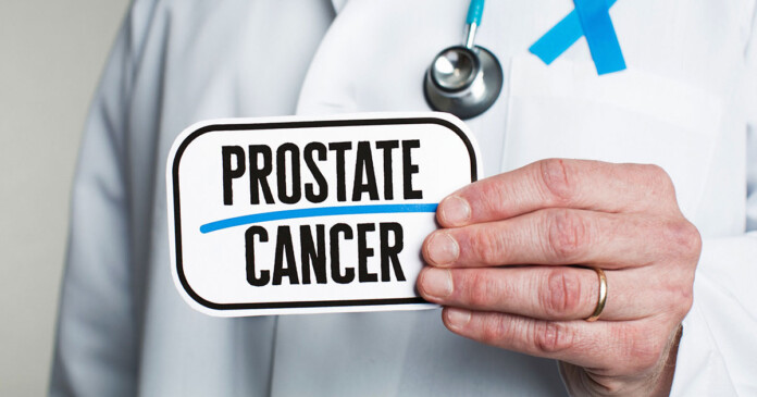 prostrate cancer