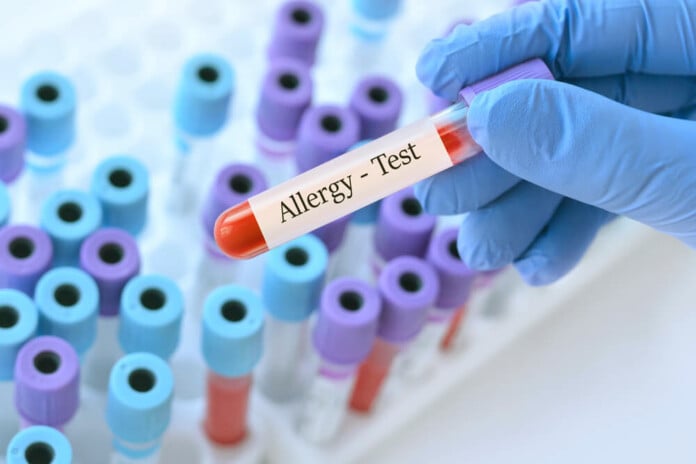 allergy test ORIGINAL