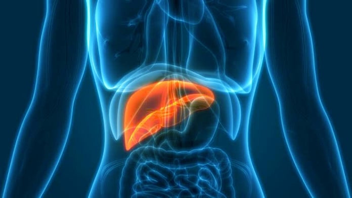 liver cancer ORIGINAL
