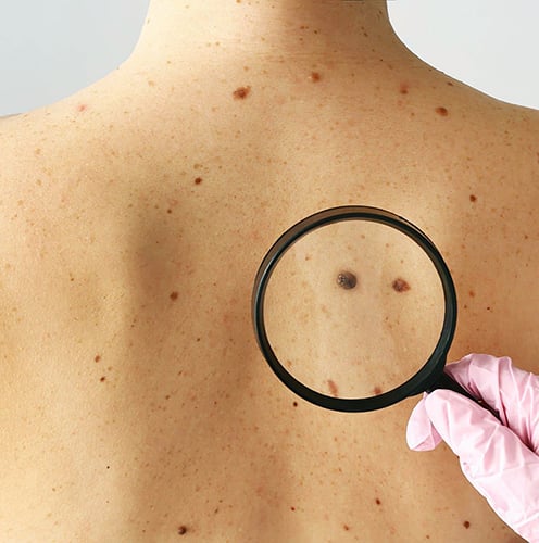 Dr Tina Blog Feature Images (1920 x 1280 px) - Early-detection-s