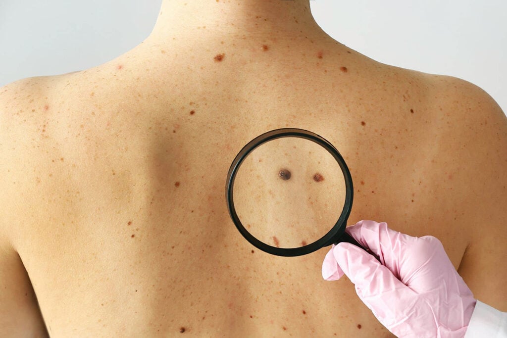 Dr Tina Blog Feature Images (1920 x 1280 px) - Early-detection-s