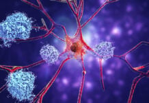 Rare Autopsy Finds Alzheimer’s Drugs Only Work in Some Parts of the Brain